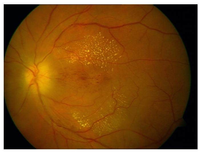 Cataract surgeon performing surgery at Vihaan Eye Hospital