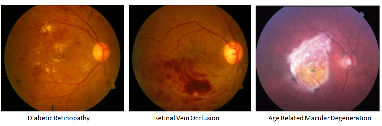 Retina Examination by Expert Retina Specialist at Vihaan Eye Care